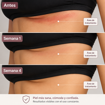 "Crema que alivia, calma y protege los pliegues de tu piel"